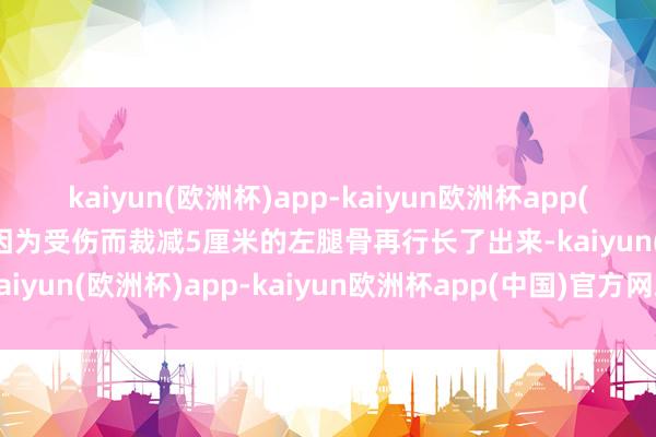 kaiyun(欧洲杯)app-kaiyun欧洲杯app(中国)官方网站-登录入口因为受伤而裁减5厘米的左腿骨再行长了出来-kaiyun(欧洲杯)app-kaiyun欧洲杯app(中国)官方网站-登录入口